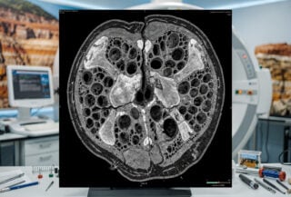 CT scan of fossil vertebra showing internal air cavities and bony structures